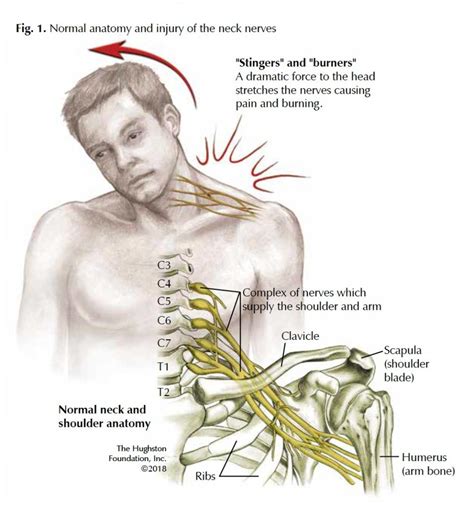 test for nerve compression|signs of pinched nerve.